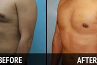  للرجال الذين يعانون من مشكلة 