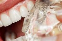 أسرار حماية الأسنان الحساسة من البرودة.. في هذا الخبر! 