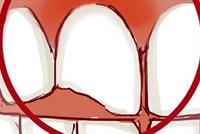 كيف يمكن إنقاذ الأسنان المكسورة؟ 