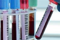  الروس يولّدون الكهرباء من دم الإنسان! 