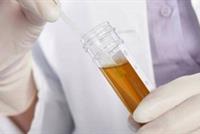  اختبار بسيط للبول يتنبأ بموعد وفاتكم! 