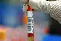  علاج جديد يُبشر بـ