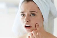 اليك أسهل طريقة للتخلّص من الرؤوس السوداء!