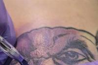 أفضل طريقة لإزالة الوشوم “تماما”