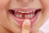  خزني اسنان طفلك بعد وقوعها لأنها قد تنقذ حياته في المستقبل! 