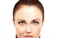 البشرة المترهلّة: ما هي أسبابها وهل يمكن تجنّبها أو معالجتها؟ 