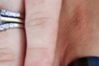  لماذا نضع خاتم الزواج في هذا الإصبع؟.. و4 نصائح