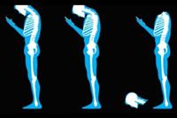 تضغط فقرات الرقبة.. هذا ما تفعله الهواتف بصحتكم 