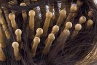 خسرت شعرها بسبب تناولها هذا النوع من الخضار!