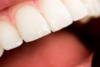 ما هي أسباب السقوط المبكر للأسنان؟