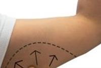 هكذا يمكنك التخلص من الدهون الزائدة في الذراعين