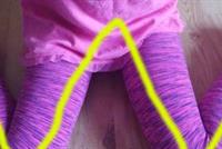 تحذير هام للأهل ...امنعوا أطفالكم من الجلوس بهذه الوضعية!