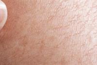 زيت الزيتون وصفار البيض لعلاج الجلد الجاف