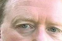 ادعى أنه فقد ذاكرته تهرباً من حماته!