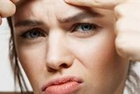 4 أطعمة مسؤولة عن حبوب البشرة