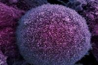 بشرى لمرضى السرطان.. اكتشاف قد ينقذ حياة الملايين