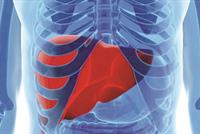 أكل اللحوم بكثرة يسبب أمراض بالكبد