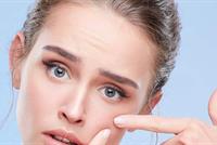 وأخيراً.. إليكِ الطريقة السهلة لإذابة البثور في يوم واحد