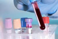 ظاهرة غريبة... رجل يتحوّل دمه إلى حليب!