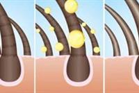 نصائح عملية و يومية لتجنب القشرة