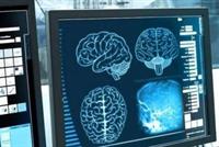 إماراتية تستعيد وعيها بعد 27 عاما من فقدانه