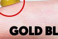 فصيلة دم ذهبية نادرة.. صاحبها يستطيع التبرُع لأي شخص!