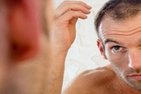 5 طرق لعلاج تساقط الشعر لدى الرجال