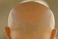 الرجل الأصلع سيصبح بمقدوره تحويل أشعة الشمس إلى طاقة