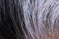 أسباب ظهور الشعر الأبيض في سن مبكر