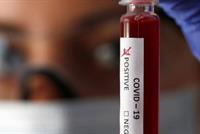 الأبحاث تكشف فصيلة الدم الأكثر عرضة لخطر كورونا