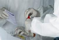 العالم مشغول.. هل يعود كورونا بعد الشفاء؟