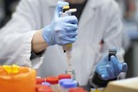 فقدان حاسّتَي الذوق والشم قد يكون علامة على الإصابة بـ