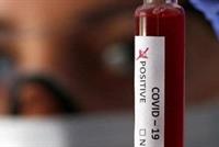  الصحة العالمية تحسم الجدل.. هل ينتشر كورونا عبر الهواء؟