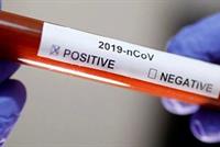 هذا التاريخ سيكون الحد الفاصل بين تراجع كورونا او انتشاره بالكامل في لبنان 