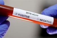 أول فنانة سورية تعلن عن إصابتها بفيروس كورونا!