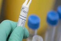 تجارب سريرية على عقار ضدّ كورونا