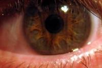  ما علاقة احمرار العين بفيروس كورونا؟ 