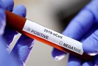 اول دولة في العالم.. 500 وفاة بالكورونا من اصل مليون نسمة!